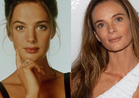 Gabrielle Anwar Plastic Surgery