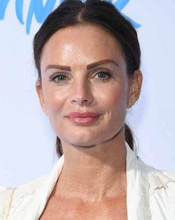 Gabrielle Anwar Plastic Surgery