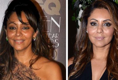 Gauri Khan Plastic Surgery