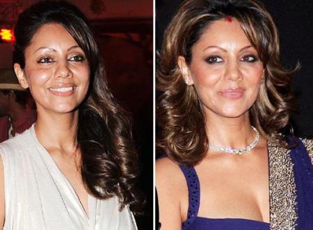 Gauri Khan Plastic Surgery