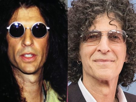 Howard Stern Plastic Surgery