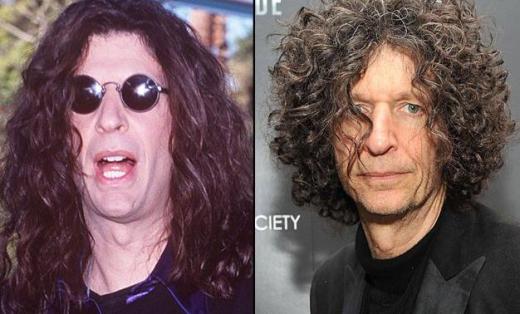 Howard Stern Plastic Surgery