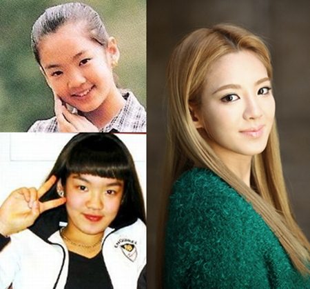 Hyoyeon Plastic Surgery