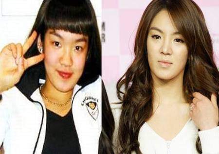 Hyoyeon Plastic Surgery