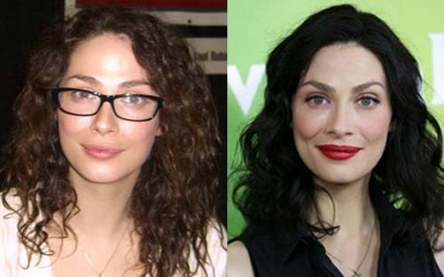 Joanne Kelly Plastic Surgery