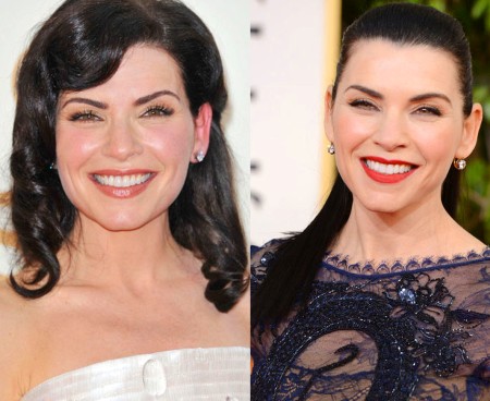 Julianna Margulies Plastic Surgery