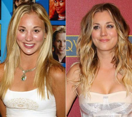 Kaley Cuoco Plastic Surgery