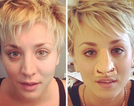 Kaley Cuoco Plastic Surgery