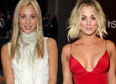 Kaley Cuoco Plastic Surgery