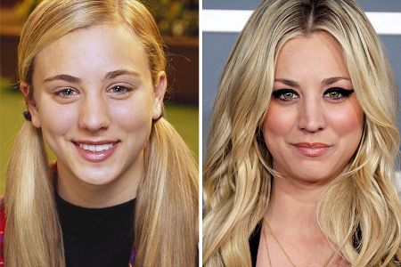 Kaley Cuoco Plastic Surgery