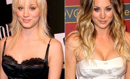 Kaley Cuoco Plastic Surgery