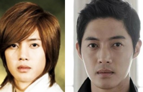 Kim Hyun Joong Plastic Surgery