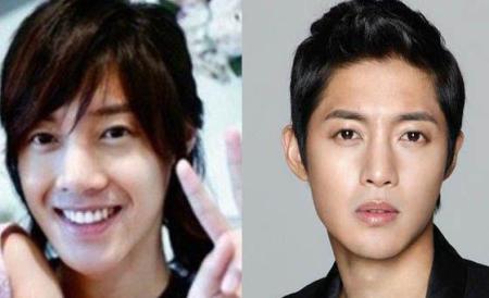 Kim Hyun Joong Plastic Surgery