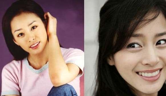 Kim Tae Hee Plastic Surgery