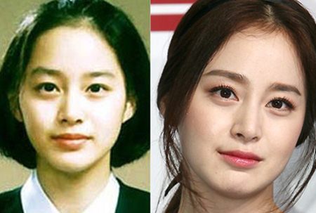 Kim Tae Hee Plastic Surgery