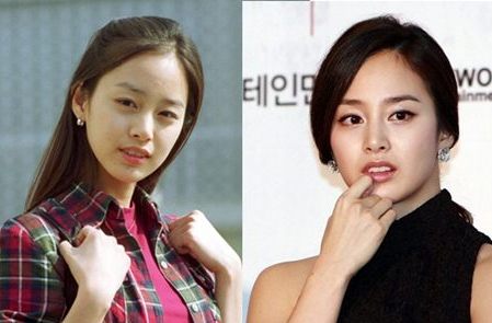 Kim Tae Hee Plastic Surgery