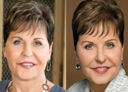 Preacher Joyce Meyer Plastic Surgery