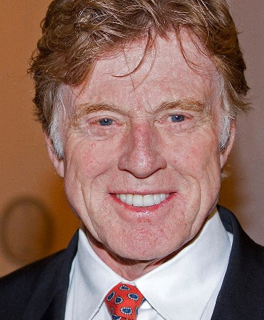 Robert Redford Plastic Surgery