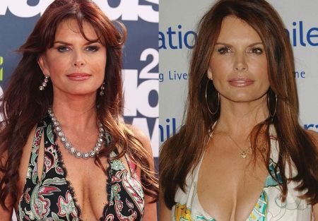 Roma Downey Plastic Surgery