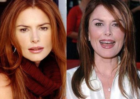 Roma Downey Plastic Surgery