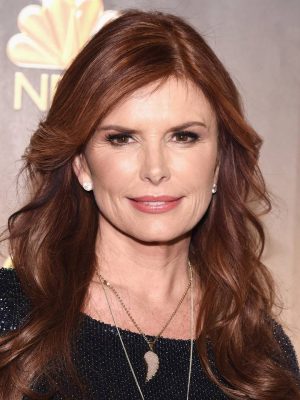 Roma Downey Plastic Surgery