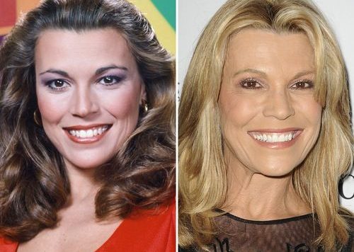 Vanna White Plastic Surgery