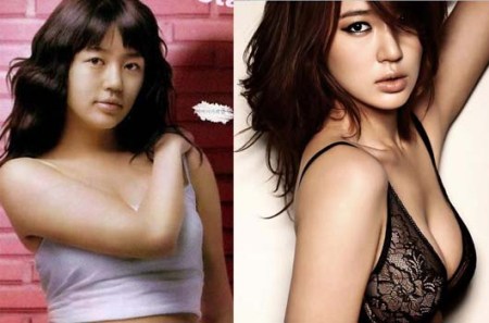 Yoon Eun Hye Plastic Surgery