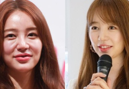 Yoon Eun Hye Plastic Surgery