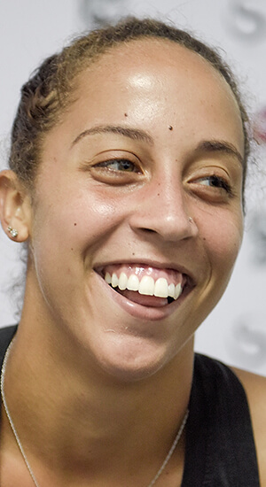 Madison Keys Plastic Surgery Face