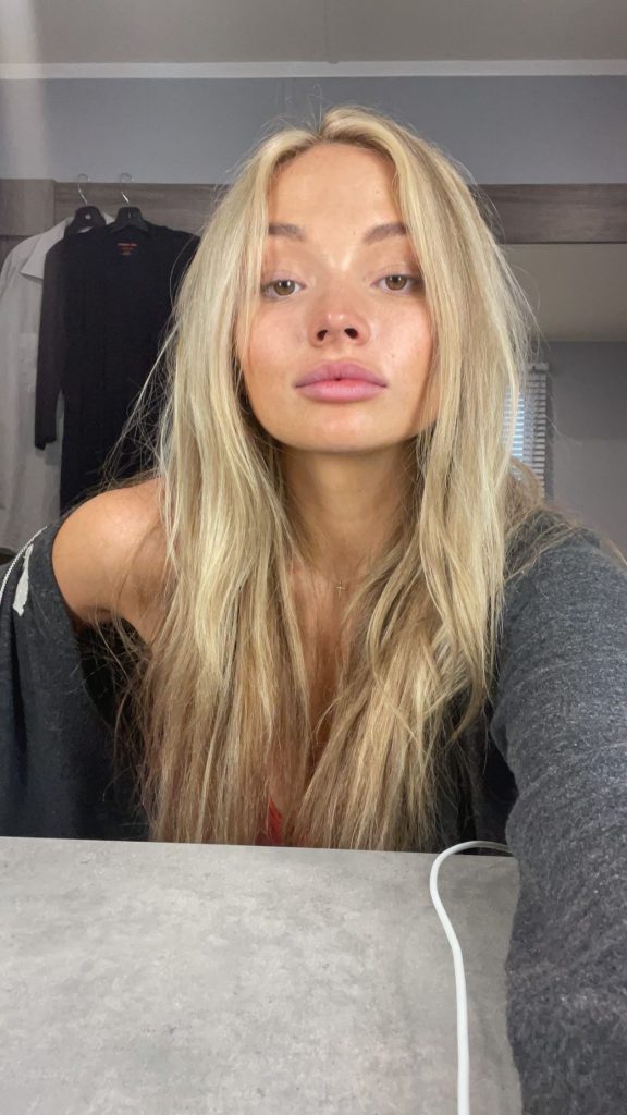 Natalie Alyn Lind Plastic Surgery Face