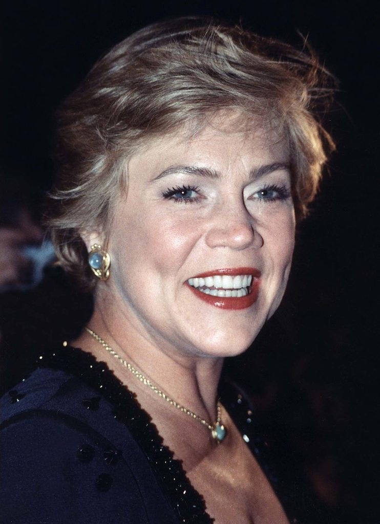 Kathleen Turner Cosmetic Surgery Face