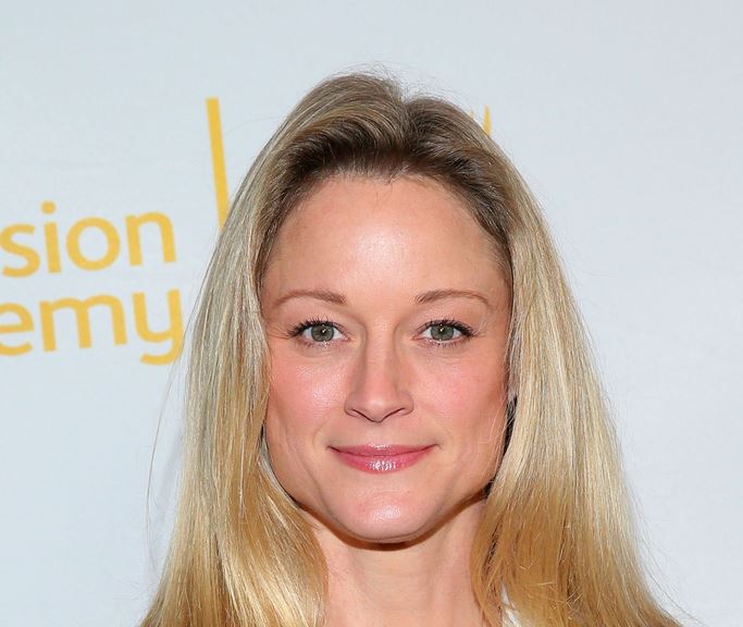 Teri Polo Cosmetic Surgery Face