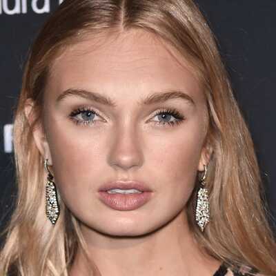 Romee Strijd Plastic Surgery Face