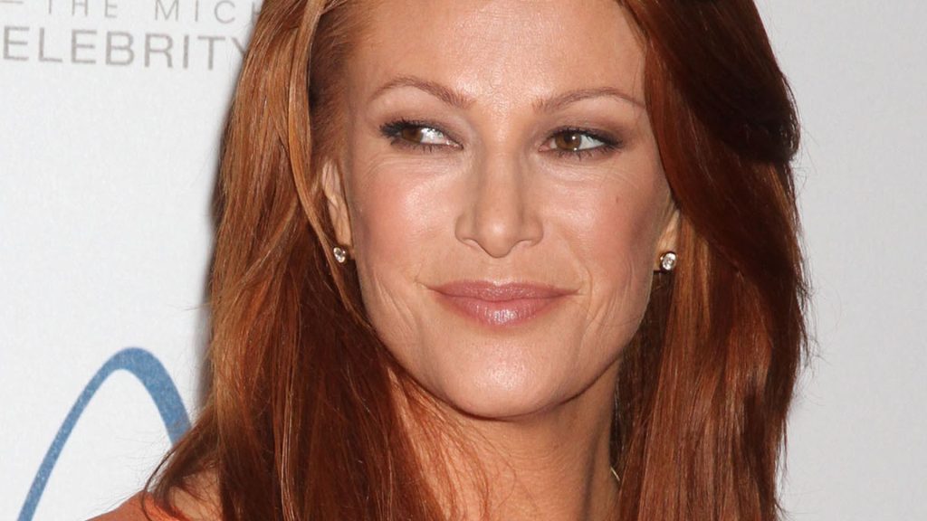 Angie Everhart Plastic Surgery Face