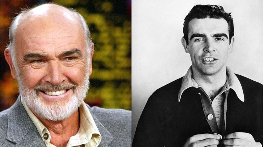 Sean Connery Plastic Surgery Face